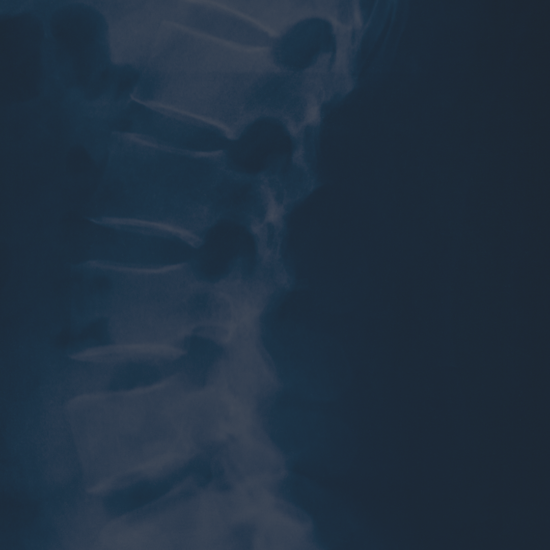 NeuroFold